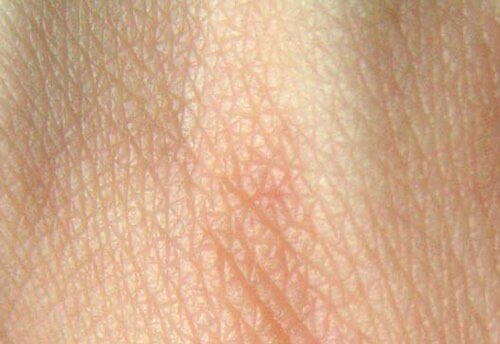 Human Skin