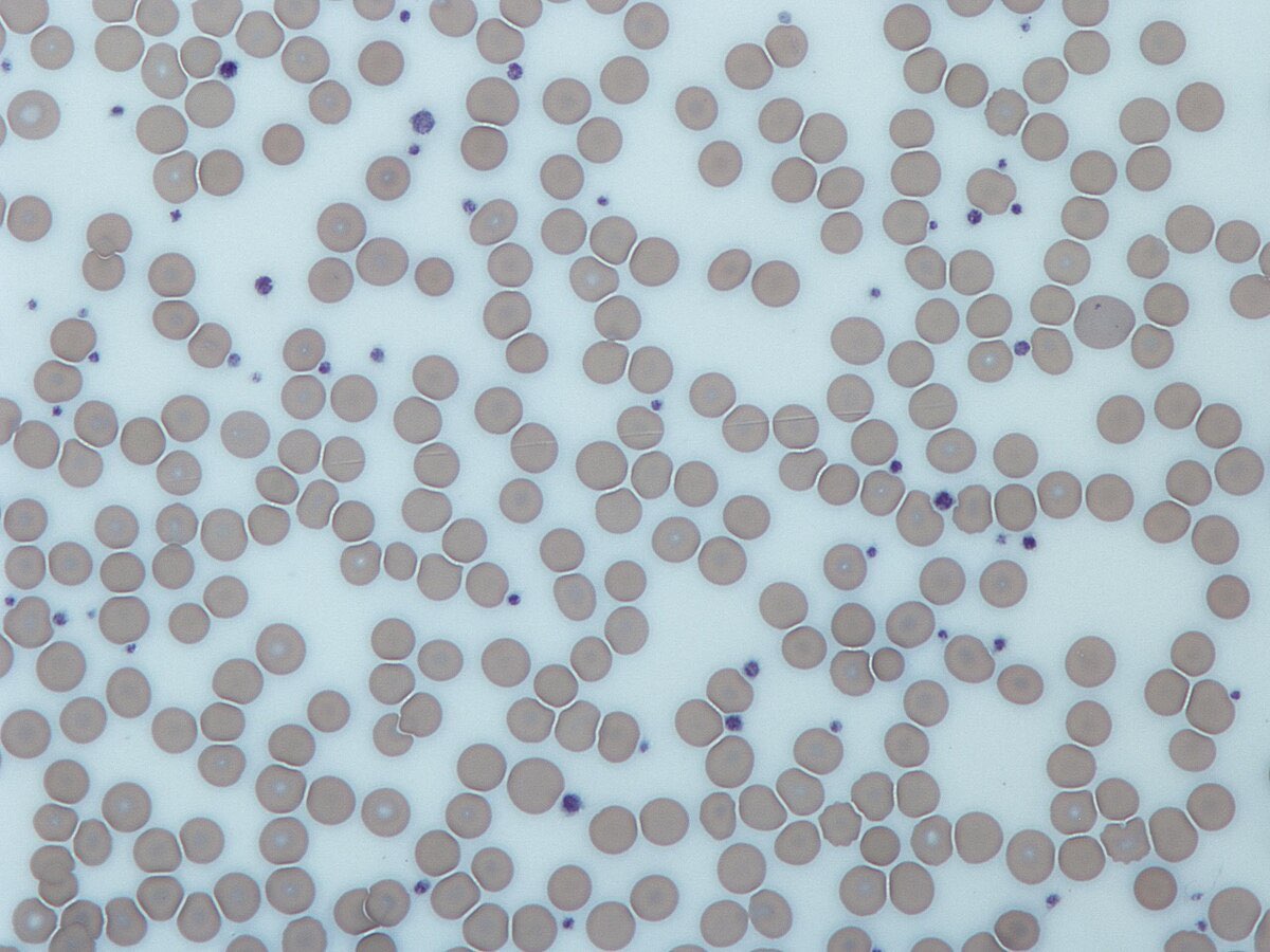 Blood Platelet